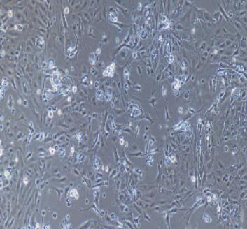 小鼠氣管上皮細胞,Tracheal Epithelial Cells