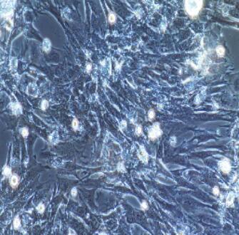 小鼠气管平滑肌细胞,Tracheal Smooth Muscle Cells
