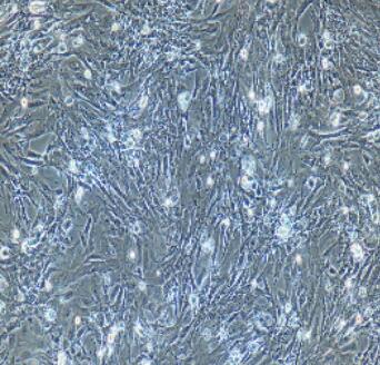 小鼠支气管平滑肌细胞,Bronchial Smooth Muscle Cells