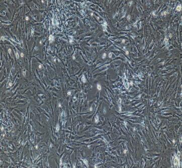 小鼠肺成纤维细胞,Pulmonary Fibroblasts Cells
