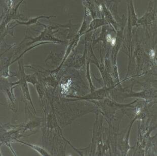 小鼠頸動脈平滑肌細胞,Carotid Artery Smooth Muscle Cells