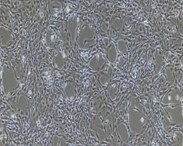 小鼠腹腔主動(dòng)脈內(nèi)皮細(xì)胞,Intraperitoneal Aortic Endothelial Cells