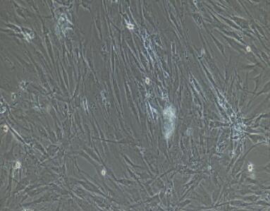 小鼠腹腔主动脉外膜成纤维细胞,Peritoneal Aortic Epicardial Fibroblasts Cells