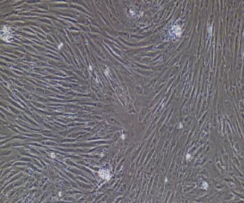 小鼠股动脉平滑肌细胞,Femoral Artery Smooth Muscle Cells