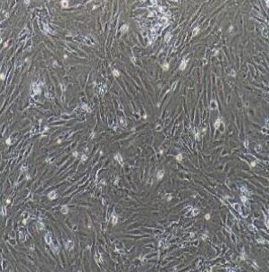 小鼠颈动脉成纤维细胞,Carotid Fibroblasts Cells