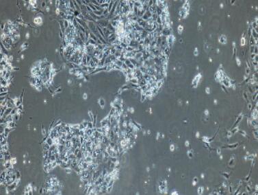 小鼠胆囊上皮细胞,Gallbladder Epithelial Cells