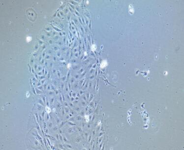 小鼠肝外膽管上皮細(xì)胞,Extrahepatic bile Duct Epithelial Cells