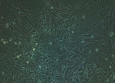 小鼠肝星状细胞,Hepatic Stellate Cells