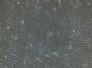 小鼠肝窦内皮细胞,Sinusoidal Endothelial Cells