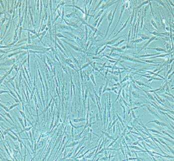 小鼠膀胱基质成纤维细胞,Bladder Matrix Fibroblasts Cells