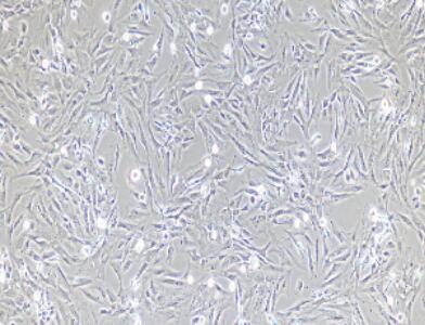 小鼠前列腺成纤维细胞,Prostate Fibroblasts Cells