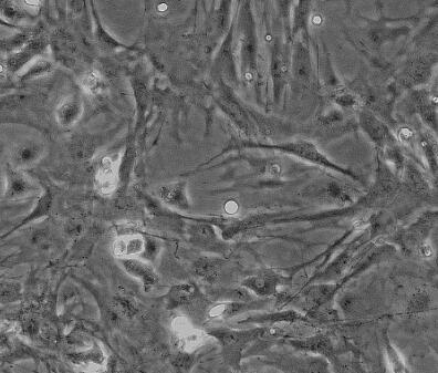 小鼠肝間質(zhì)細(xì)胞,Liver Interstitial Cells