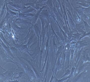 小鼠膀胱平滑肌细胞,Bladder Smooth Muscle Cells