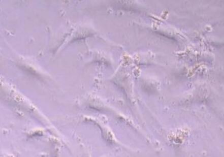 小鼠肾系膜成纤维细胞,Mouse Mesangial Fibroblasts Cells