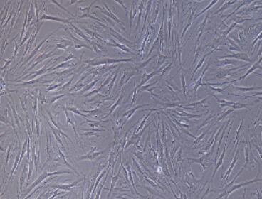 小鼠甲状腺成纤维细胞,Thyroid Fibroblasts Cells