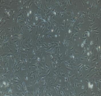 小鼠腎上腺皮質(zhì)細胞,Adrenal Cortical Cells