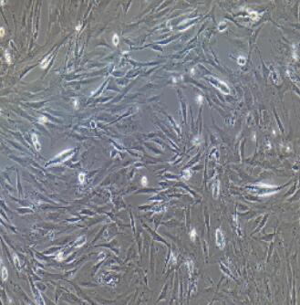 小鼠乳腺成纤维细胞,Breast Fibroblasts Cells