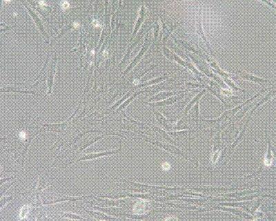 小鼠子宫成纤维细胞,Mouse Uterine Fibroblasts Cells