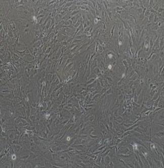 小鼠滑膜成纤维细胞,Synovial Fibroblasts Cells