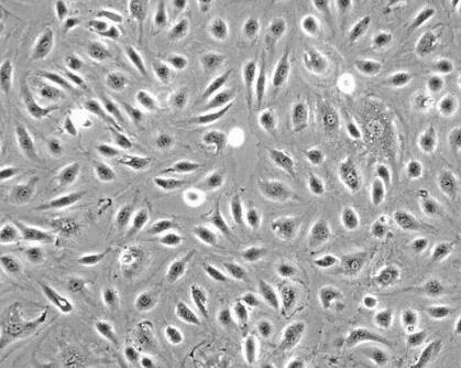 小鼠纖維環(huán)細(xì)胞,Fibroblasts Cells