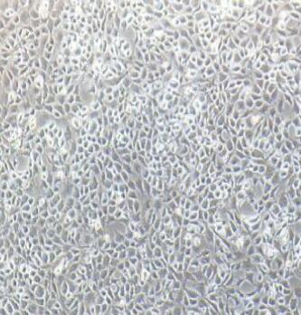 小鼠髓核细胞,Nucleus Pulposus Cells