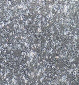 小鼠皮肤成纤维细胞,Skin Fibroblasts Cells