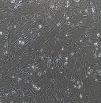 小鼠前脂肪细胞,Preadipocytes Cells