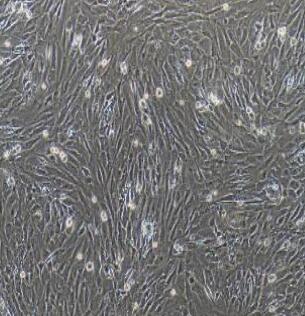 小鼠骨髓间充质干细胞,Bone Marrow Mesenchymal Stem Cells