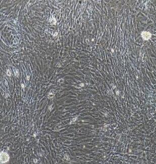 小鼠淋巴管内皮细胞,Lymphatic Endothelial Cells