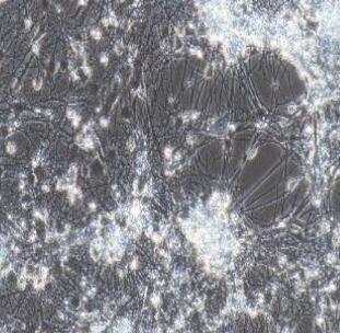 小鼠脾源性内皮祖细胞,Spleen - derived Endothelial Progenitor Cells