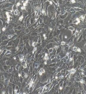 小鼠椎体终板软骨细胞