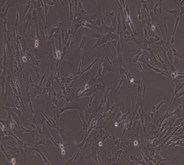 小鼠脉络膜微血管内皮细胞,Choroidal Microvascular Endothelial Cells