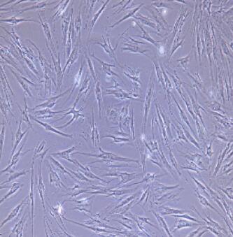 小鼠脉胳膜成纤维细胞,Tubular Membrane Fibroblasts Cells