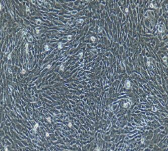 小鼠视网膜微血管内皮细胞,Retinal Microvascular Endothelial Cells