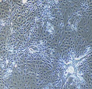 小鼠晶状体上皮细胞,Lens Epithelial Cells