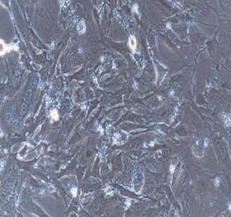 小鼠结膜成纤维细胞,Conjunctival Fibroblasts Cells