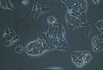 小鼠脐静脉内皮细胞,Umbilical Vein Endothelial Cells