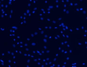 兔脉胳膜成纤维细胞,Tubular Membrane Fibroblasts Cells