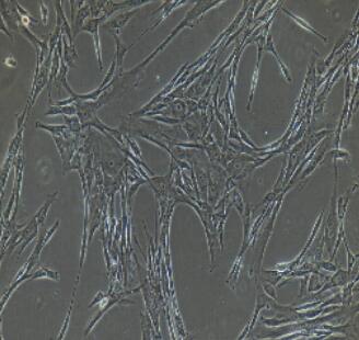 兔主动脉平滑肌细胞,Aortic Smooth Muscle Cells