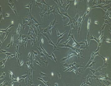 兔冠狀動脈內(nèi)皮細胞,Coronary Artery Endothelial Cells