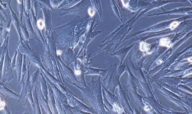 兔頸動(dòng)脈平滑肌細(xì)胞,Carotid Artery Smooth Muscle Cells