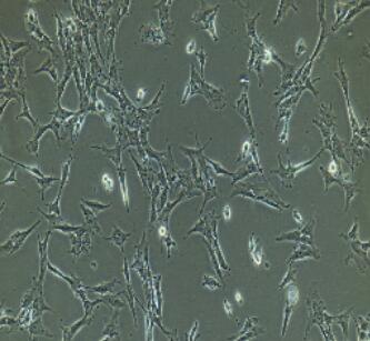 兔腹腔主動脈內(nèi)皮細(xì)胞,Intraperitoneal Aortic Endothelial Cells