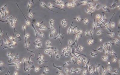 兔腹腔主動脈平滑肌細胞,Abdominal Aortic Smooth Muscle Cells