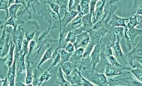 兔心臟微血管內(nèi)皮細(xì)胞,Rabbit Myocardial Microvascular Endothelial Cells