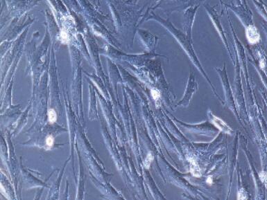 兔肝星状细胞,Hepatic Stellate Cells