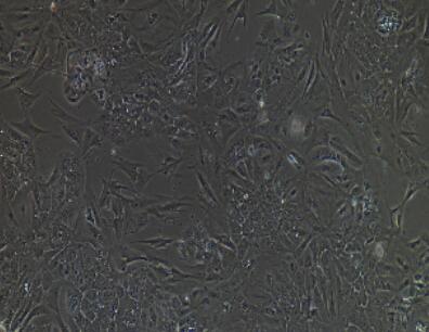 兔胰腺星状细胞,Pancreatic Stellate Cells