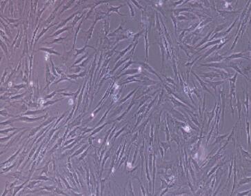 兔結(jié)腸成纖維細(xì)胞,Colon Fibroblasts Cells