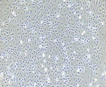 兔肝窦内皮细胞,Sinusoidal Endothelial Cells