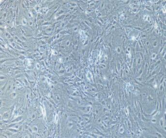 兔肾小球内皮细胞,Glomerular Endothelial Cells