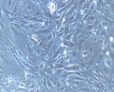 兔破骨细胞,Osteoclasts Cells